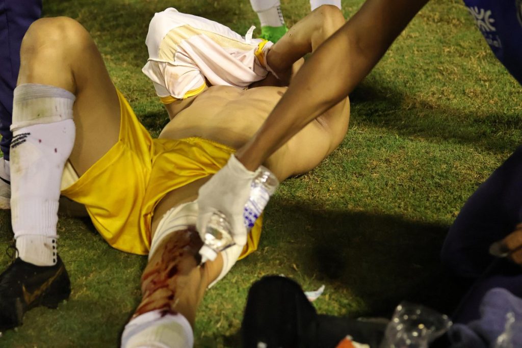 En Brasil: Un policía le disparó a un jugador de fútbol al final del partido
